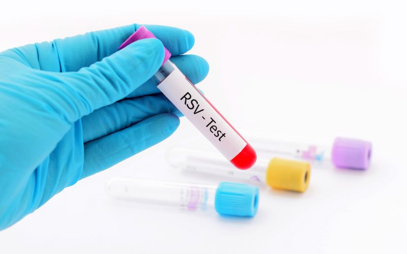Điều trị RSV bao lâu thì khỏi? Cha mẹ cần chuẩn bị gì? dieu-tri-rsv-bao-lau
