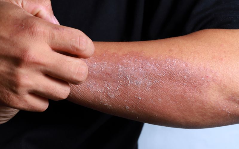 Làm sao cân bằng độ ẩm không khí trời hanh khô mùa lạnh? do-am-khong-khi-troi-hanh-kho-1
