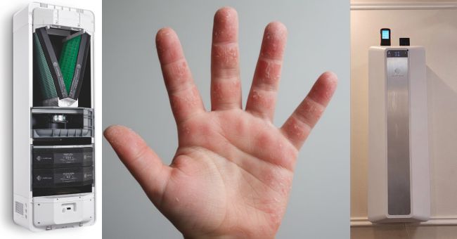 “Viêm da cơ địa ở tay: 5 nguyên nhân phổ biến và cách cải thiện hiệu quả” Viêm da cơ địa ở tay