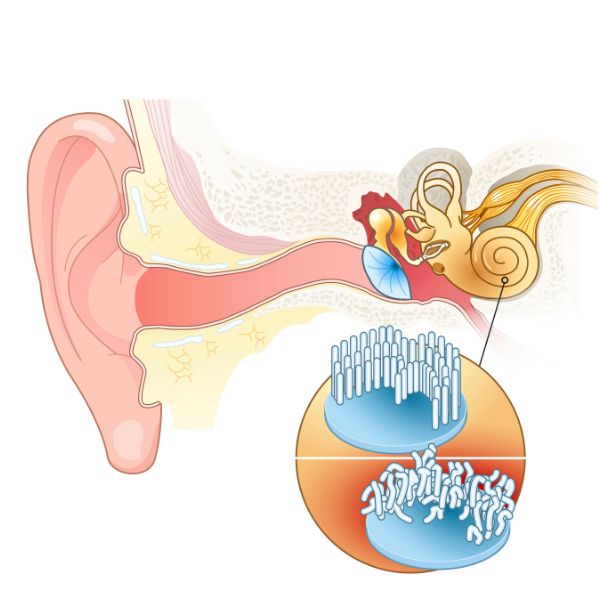 trẻ bị viêm mũi dị ứng có thể bị viêm tai giữa