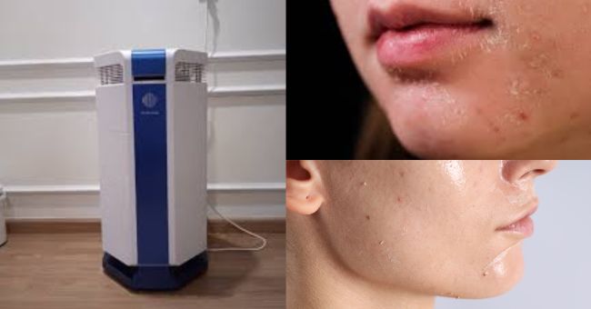 Nằm phòng điều hòa không bị khô: Bí quyết giữ ẩm và bảo vệ sức khỏe hiệu quả nằm phòng điều hoa bị khô da