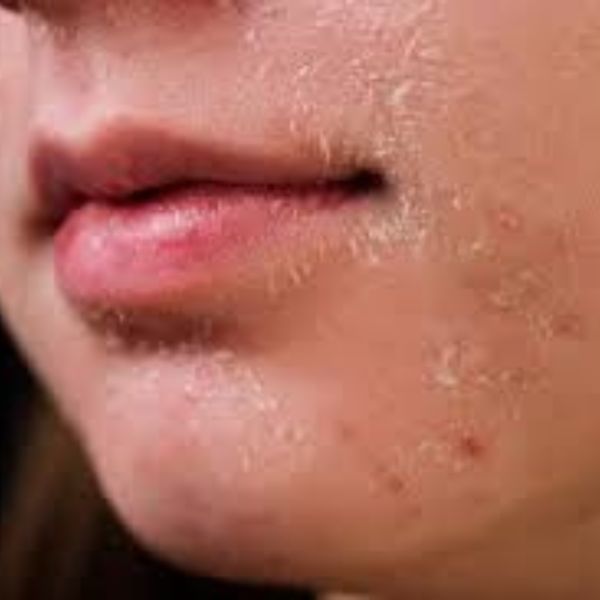 Tăng độ ẩm phòng điều hoà: 7 cách hiệu quả giúp không khí dễ chịu da nứt nẻ