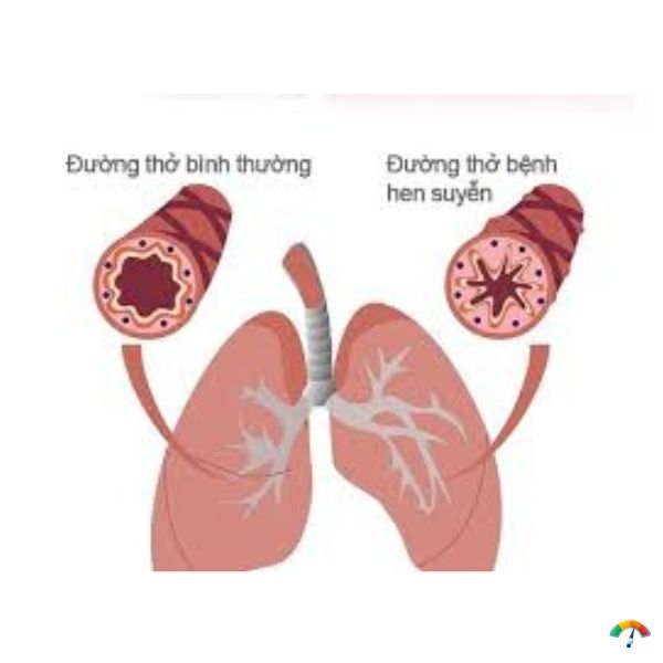 Mẹ bầu khó thở em bé có sao không? Tìm hiểu nguyên nhân và giải pháp an toàn hen suyễn ở bà bầu